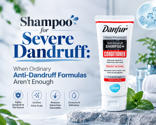 Shampoo for Severe Dandruff: When Ordinary Anti-Dandruff Formulas Aren't Enough - Danfur Shampoo and Conditioner